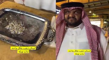 بالفيديو مزاد علي أسنان ذهبية لشخص متوفي في إحدي أسواق الرياض