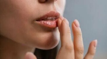 5 زيوت طبيعية لترطيب الشفاه فى الصيف.. خليها ناعمة طول الوقت –  سبق 24