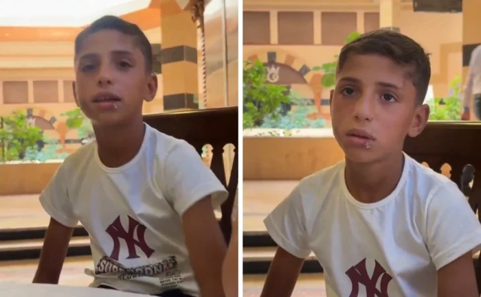 الطفل السوري ضحية تعذيب عمه في حماة يظهر لأول مرة أمام الكاميرات