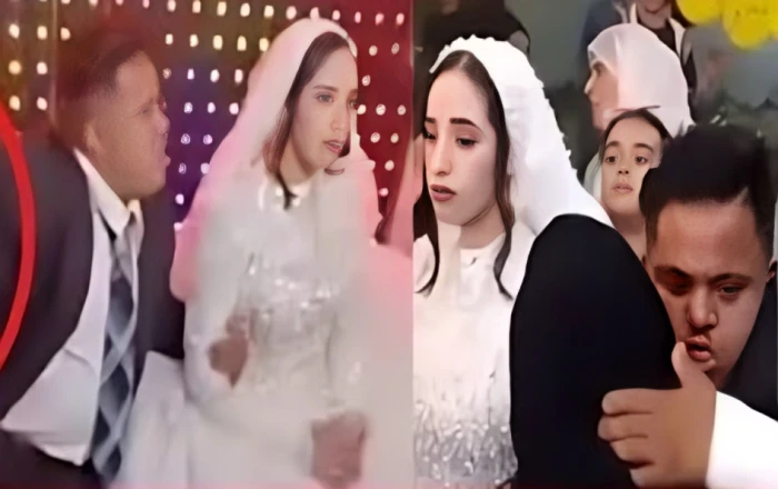 عريس متلازمة داون يشعل الجدل في مصر.. أسرة العريس تعلق لأول مرة