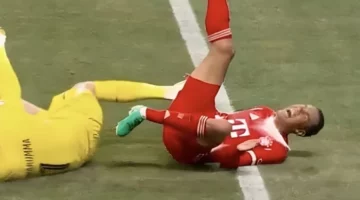 إصابة جمال موسيالا لاعب بايرن ميونخ المروعة أمام باريس تثير صدمة الجماهير
